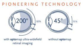 Diagram: optomap views 200° (about 82%) of the retina, compared with 45° (about 15%) without optomap